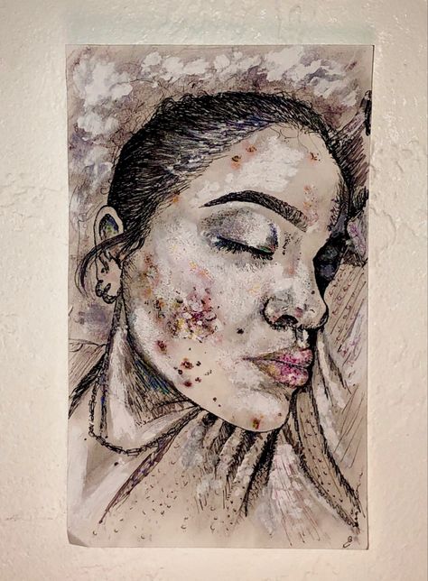 Acne Art Drawing, Acne Aesthetic Art, Acne Illustration Art, Drawing Acne, How To Draw Acne, Acne Positivity Art, Painting On Insecurity, Insecure Face Drawing, Imperfections Art