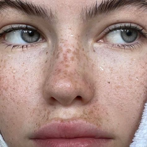 Olive Smith, Easy Girl, Freckles Makeup, Beautiful Freckles, Freckles Girl, Freckle Face, Face Aesthetic, Simple Shoes, Bare Face