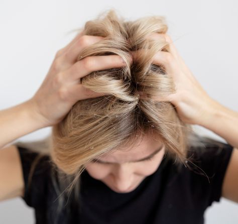 5 Best Itchy Scalp Shampoos, According to Master Trichologist Itchy Flaky Scalp, Shampoo For Itchy Scalp, How To Treat Dandruff, Scalp Itch, Shampoo For Dry Scalp, Dry Itchy Scalp, Scalp Shampoo, Hair Care Brands, Anti Dandruff Shampoo