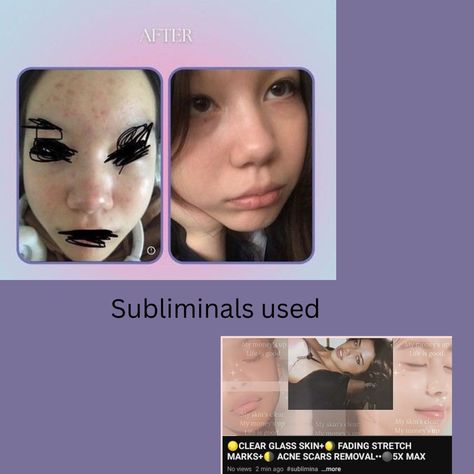 Clear Skin Subliminal Results, Body Pimples, Subliminals Aesthetic, Serious Skin Care, Makeup Artist Tips, Perfect Skin Care Routine, روتين العناية بالبشرة, Girl Tips, Glow Up Tips