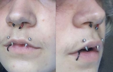 Angel Bites Fangs, Vertical Angel Bites, Angel Fangs, Unusual Piercings, Angel Bites Piercing, Angel Bites, Vertical Labret Piercing, Vertical Labret, Nonbinary People