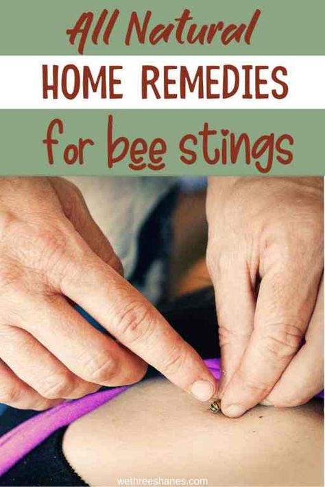 Bee Sting Remedy, Treating Bee Stings, Hornet Sting, Remedies For Bee Stings, Bug Bite Relief, Bite Relief, Wasp Stings, Acne Prone Skin Care, Bee Swarm