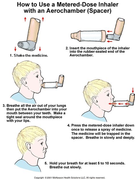 How to use an inhaler with a spacer Pharm Tech, Nurse Educator, Severe Asthma, Asthma Inhaler, Pharmacy Tech, Respiratory Therapy, School Info, Nurse Stuff, College Stuff