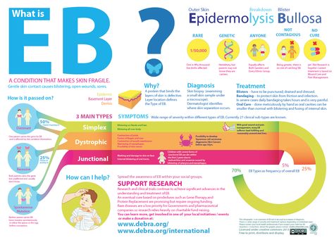 An Infographic for Epidermolysis Bullosa Awareness Week. This will give you the basics of this rare, genetic condition. Digestive System Anatomy, Epidermolysis Bullosa, Healthcare Infographics, Butterfly Kids, Skin Disorders, Health Conditions, Digestive System, Dermatology, Ultrasound