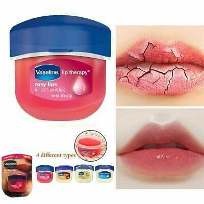 Vaseline Lip Therapy, Vaseline Lip, Rosy Lips, Organic Lip Balm, Petroleum Jelly, Natural Moisturizer, Gloss Lipstick, Organic Plants, Dry Lips