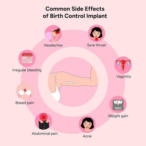 Common side effects from birth control i... | Premium Vector #Freepik #vector #concept #information #healthcare #medication Contraceptives Poster, Implant Birth Control, Birth Control Implant, Pregnancy Side Effects, Medical Study, Contraception Methods, Contraceptive Pill, Pumping Breastmilk, Nursing School Motivation