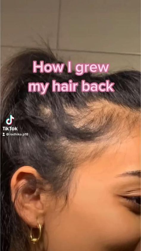 Hair Growth Tips [Video] in 2021 | Hair maintenance, Curly hair tips, Hair care Homemade Hair Treatments, Hair Mask For Growth, Long Hair Tips, Hair Growing Tips, Homemade Hair, Healthy Advice, Diy Hair Mask, Hair Growing, Hair Tips Video