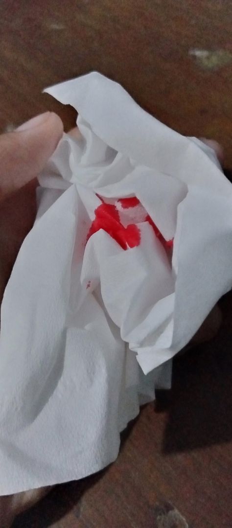 Foto Tangan Cewek Di Gores Kaca, Pap Batuk Darah, Nose Bleeds Fake Photo Tissue, Blood Oath Photo For Clients, Blood Tissue Snapstreaks, Blood Oath Picture Format, Pad With Blood, Gores Tangan, Blood Oath Picture For Client