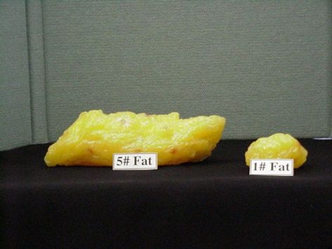 Good motivation: One pound of fat may be more than you realize 5 Lbs Of Fat, One Pound Of Fat, Lose 5 Pounds, Pound Of Fat, Migraine Headaches, Quick Healthy, Lose 20 Pounds, Migraine, Fitness Nutrition