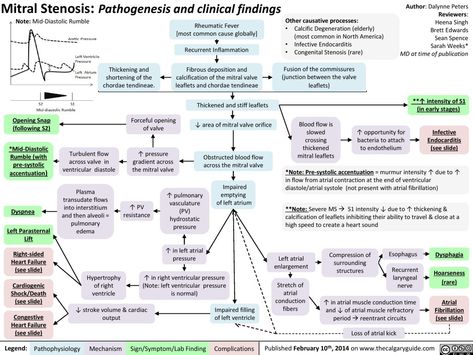 Mitral Stenosis: Pathogenesis and Clinical Findings | Calgary Guide Cardiac Pathology, Mitral Stenosis, Tissue Biology, Nursing Information, Medicine Studies, Cardiac Nursing, Medical Laboratory Science, Medical School Motivation, Medical Facts