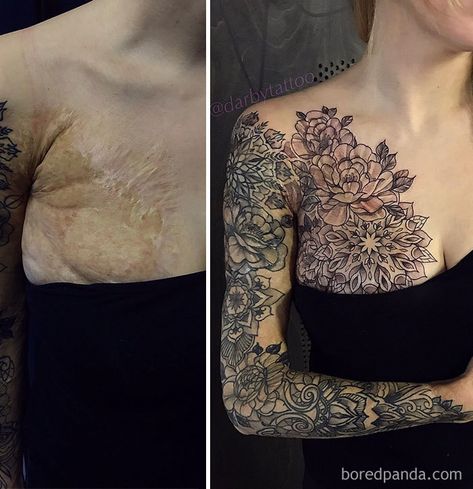 Birthmark Tattoo, Tato 3d, Tattoo Over Scar, Mastectomy Tattoo, Scar Cover Up, Tattoos To Cover Scars, Scar Tattoo, Clever Tattoos, Tattoo Shows