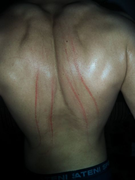 #back #scratches Scratched Back Hot, Back With Hickey, Back Scratches From Nails, Nails Scratching On Back Couple Pic, Nail Scratches Back, Back With Scratches, Hot Things To Do For Your Boyfriend, Scratched Back From Nails, Guy With Scratch On Back