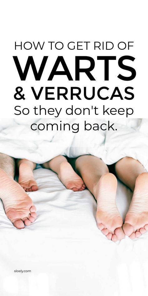 Learn how to get rid of warts and verrucas so they don't come back. These simple home remedies remove warts and verrucas and prevent them returning. #getridofwarts #warts #wartremedy #removewarts How To Treat Warts, Verruca Removal, What Causes Warts, Flat Warts, Don't Come Back, Home Remedies For Warts, Remove Skin Tags Naturally, Warts Remedy, Remove Warts