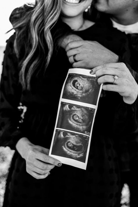 Ultrasound Couple Photos, Ultrasound Maternity Pictures, Pregnancy Announcement Ultrasound Photo, Early Pregnancy Photoshoot, Black And White Pregnancy Photos, Black And White Maternity Shoot, Sonogram Pregnancy Announcement, Mummy Outfit, Pregnancy Aesthetic