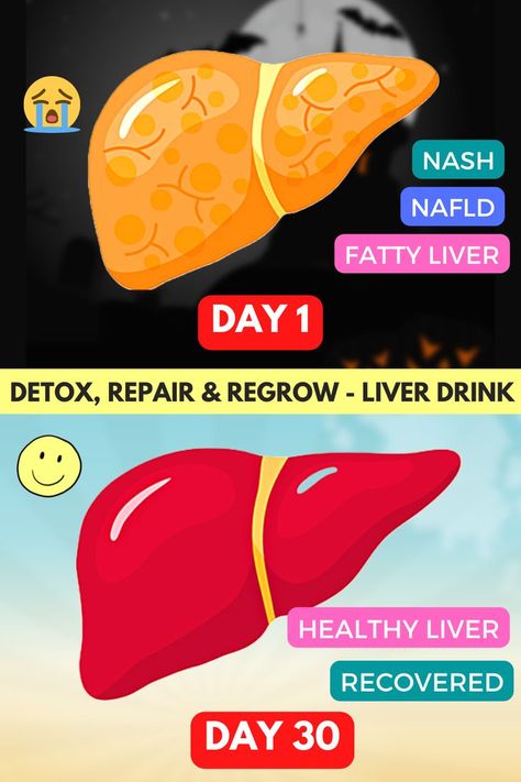 Liver Diet Plan, Liver Detox Juice, Cleansing Drink, Liver Cleanse Juice, Liver Cleansing, Heal Liver, Kidney Detox, Detox Your Liver, Cleanse Your Liver