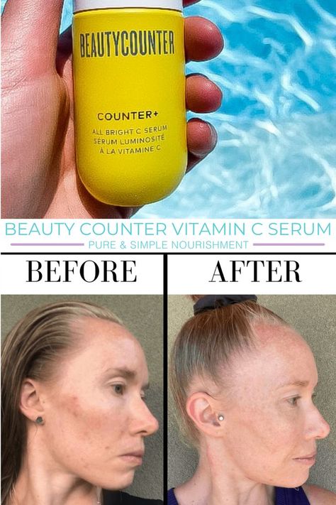 In this post I’m sharing my review of the Beautycounter Vitamin C serum as well as my before and after photos and results. I also share how to use it, how I incorporate it into my routine and the benefits of using a vitamin C serum. Benefits Of Vitamin C, Best Vitamin C Serum, Best Vitamin C, Vitamin C Benefits, My Routine, Glass Packaging, Peeling Skin, Skin Care Remedies, Vitamin C Serum