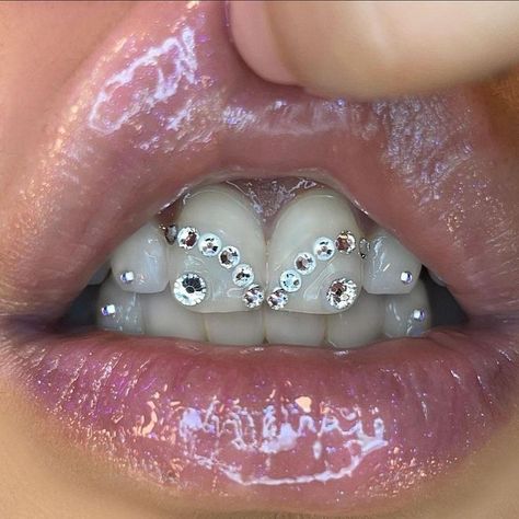 Tooth Gem Designs, Pretty Teeth, Grillz Teeth, Diamond Teeth, Tooth Gems, Grills Teeth, Tooth Gem, Teeth Jewelry, Glo Up