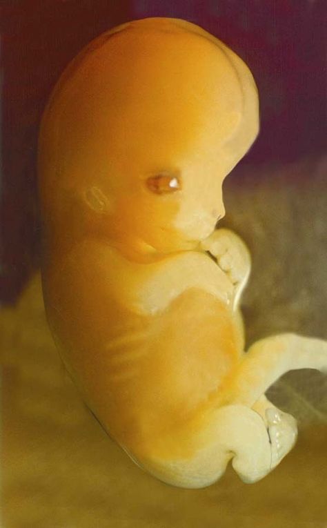 Science and technology have given us a better understanding of the unborn child. These little humans are amazing, and these photos help to show that they are not potential humans, but rather, humans with potential. The thumbnail you saw earlier is a baby at 4 months gestation. 7 Weeks Pregnant, 4 Month Baby, Fra Angelico, Fetal Development, Baby Stage, Life Is Precious, Unborn Baby, Planned Parenthood, Baby Development