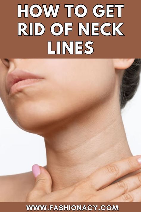 How To Get Rid of Neck Lines Get Rid Of Neck Lines, Remove Neck Lines, Neck Wrinkles Remedies, Natural Wrinkle Remedies, Home Remedies For Wrinkles, Different Types Of Acne, Blind Pimple, Thick Moisturizer, Dermatologist Recommended Skincare