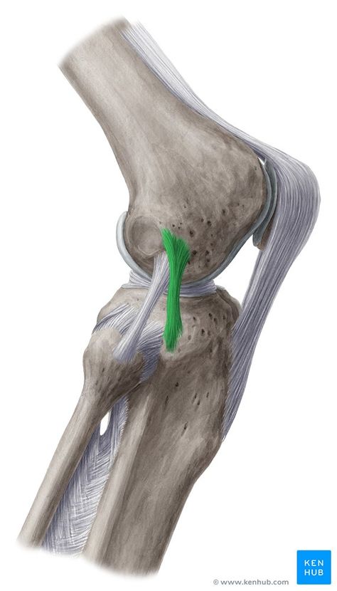 Anterolateral ligament - lateral view Ankle Anatomy, Avulsion Fracture, Types Of Fractures, Knee Bones, Knee Ligaments, Anterior Cruciate Ligament, Anatomy Bones, Cruciate Ligament, Magnetic Resonance Imaging