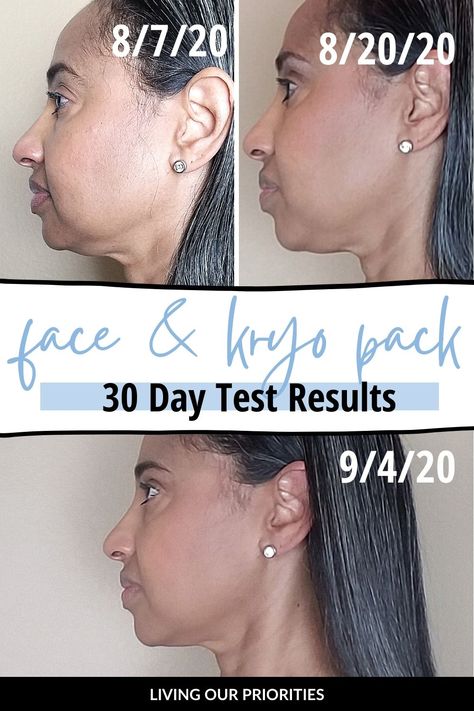 Fascia Blasting Face Tutorial With Kryo Pack - Fascia Blasting How To, Fascia Blasting Face Before And After, Facia Blasting Before And After, Fascia Blaster Before And After, Fascia Flossing, Fascia Health, Ashley Black Fascia Blaster, Face Blaster, What Is Fascia