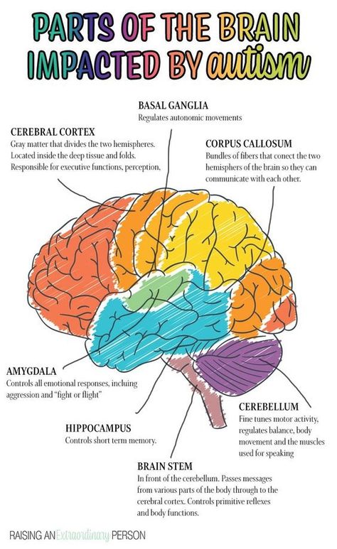 Informational Parts Of The Brain, Sistem Saraf, The Human Brain, Spectrum Disorder, Human Brain, The Brain, Brain, Human, History