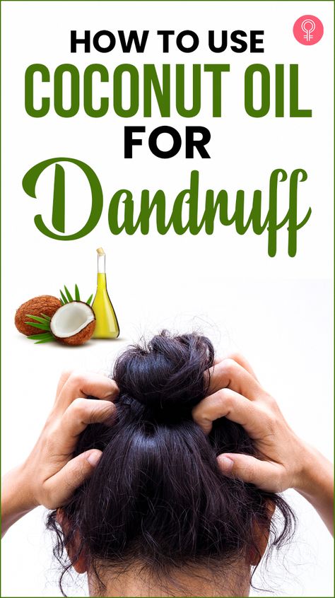 Wondering how to use coconut oil for dandruff? If yes, then you are on the right page. Read on to know more about coconut oil, its benefits, and how to use it. Coconut Oil For Dandruff, Coconut Oil Remedies, Natural Dandruff Remedy, Hair Mask For Dandruff, Coconut Oil Mask, Oils For Dandruff, Dandruff Remedy, Diy Coconut Oil, Best Hair Care