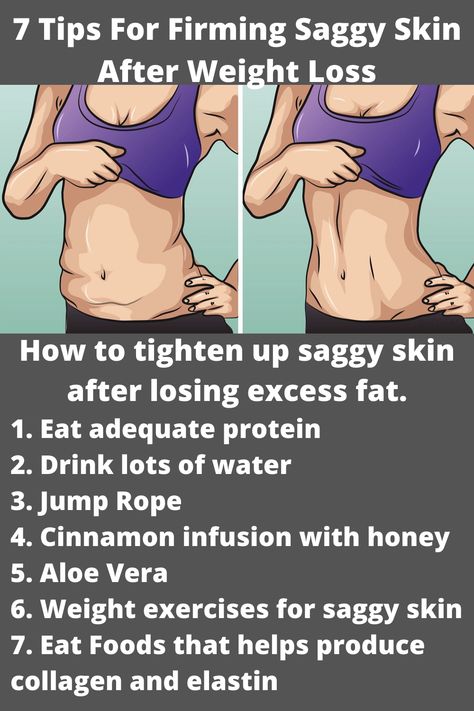 An image showing a saggy skin resulting from excess weight loss and a second image showing tightened skin as corrected by applying the 7 tips for firming saggy skin after weight loss. Loose Belly, Tighten Loose Skin, Lose Thigh Fat, Excess Skin, Saggy Skin, Costa Rican, Loose Skin, Sagging Skin, Skin Tightening