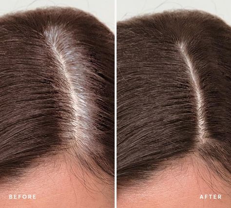 Before and After Root Reboot Application Sea Salt Shampoo, Before And After Hair, Covering Grey Roots, Madison Reed, Covering Gray Hair, Grey Roots, Root Touch Up, Scalp Scrub, Before After Photo