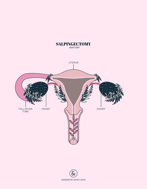 Ectopic Pregnancy Loss, Pregnancy Anatomy, Angel Baby Quotes, Pregnancy Tattoo, Fertility Quotes, Pregnancy Illustration, Anatomy Illustration, Duvet Day, Ivf Baby