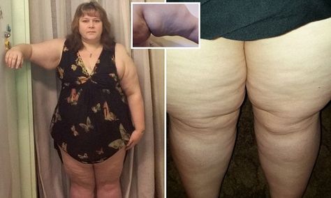 Heavy Legs, Female Reference, Diet And Exercise, Lower Body, Norfolk, Sense, Diet, Plus Size, Health