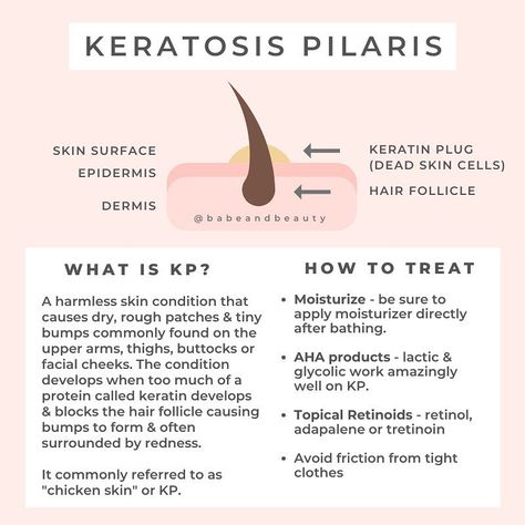 Dana | Holistic Esthetician on Instagram: “Keratosis pilaris (ker-uh-TOE-sis pih-LAIR-is), commonly nicknamed "chicken skin" or for short KP. This skin condition is pretty common,…” Skincare Facts, Holistic Skin Care, Skin Facts, Skin Care Business, Skin Advice, Skin Aesthetics, Keratosis Pilaris, Skin Science, Increase Sales