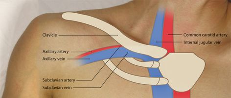 Ultrasound-Guided Subclavian Vein Cannulation: Procedures - Introduction | SonoSim Subclavian Vein, Ultrasound, Right Now, Accounting