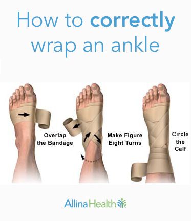 In this picture, we demonstrate three steps on how to correctly wrap an ankle with pictures. K Tape, 1000 Lifehacks, First Aid Tips, Diy Centerpiece, Survival Life Hacks, Trening Fitness, Sprained Ankle, Survival Life, Athletic Training