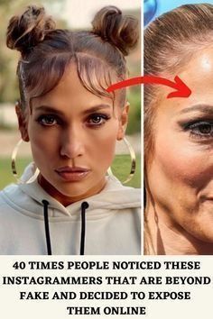 Celebrity Plastic Surgery, Celebrity Trends, Celebrity Beauty, Beauty Standards, Viral Trend, Crazy People, I Know It, Celebrity Look, Homecoming Makeup