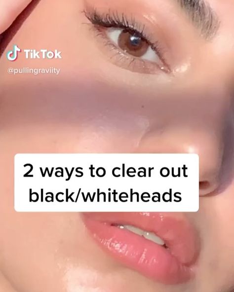 @poppin_skin on Instagram: “2 ways to clear out white/black heads • Clay masks recommended can be The Indian Clay mask sold on Amazon • Chemical exfoliant can be The…” White Heads On Nose, Clean Nose Pores, Get Rid Of Pores, Nose Pores, Blackheads On Nose, Open Pores, Pigmented Lips, How To Get Rid Of Pimples, Get Rid Of Blackheads