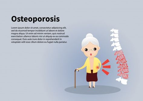 Anciano con osteoporosis Campaign Design, Medical Wallpaper, Digital Campaign, Graphic Editing, Old Man, Old Men, Vector Background, Premium Vector, Graphic Resources