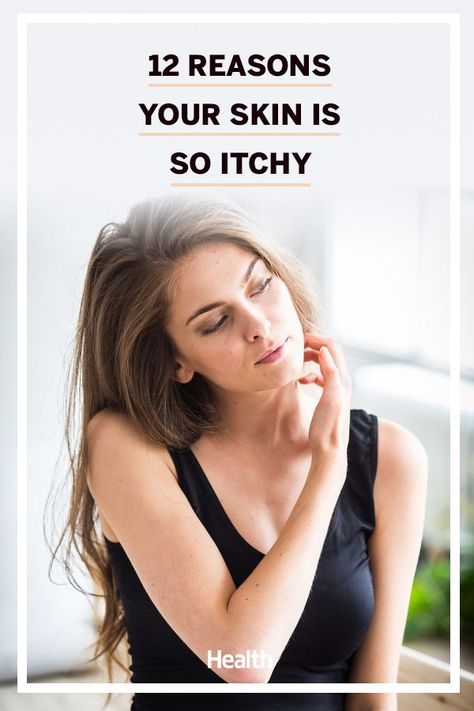 Here, Find out what's causing your constant urge to scratch so you can figure out how to treat it. #skincare #healthandwellness Itchy Skin Causes, Relieve Itchy Skin, Itchy Face, Itchy Rash, Scaly Skin, Health Routine, Top Skin Care Products, Insect Bites, Itchy Skin