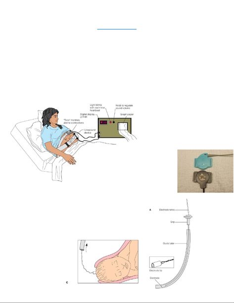 1-FHM - fetal heart rate monitoring - FETAL MONITORING **2 parts to fetal heart tracing (FHT) Fetal - StuDocu Heart Tracing, Valsalva Maneuver, Fetal Monitoring, Fetal Heart Rate, Fetal Movement, Contractions Labor, Iv Fluids, Concordia University, Vagus Nerve