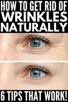 How to Get Rid of Wrinkles | If you have fine lines on your forehead, under your eyes, on your neck, and on other parts of your face, including around your mouth and on your lips, these beauty hacks and DIY hydrating face masks will restore your skin’s elasticity naturally…and fast! Forget those expensive anti-aging creams and opt for these natural remedies that work! #getridofwrinkles #antiaging #skincare Hydrating Face Mask Diy, Wrinkles Remedies, Wrinkles Remedies Face, Pore Shrinking, Mouth Wrinkles, Wrinkles Hands, Get Rid Of Wrinkles, Antiaging Skincare, Eye Wrinkles