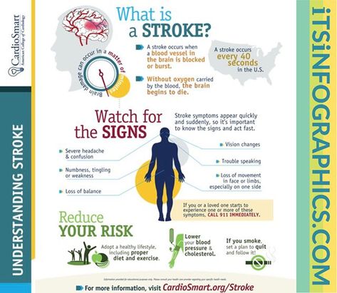 #Infographics  Do you know what a stroke is and what signs to look for?  #Infographic   .  #stroke #strokesurvivor #strokeawareness #strokesurvivor .  itsinfographics.com . . #Infographic Infographic Posters, Types Of Strokes, Loss Of Balance, Severe Headache, Infographic Poster, Health And Fitness Tips, Blood Vessels, Do You Know What, Warning Signs