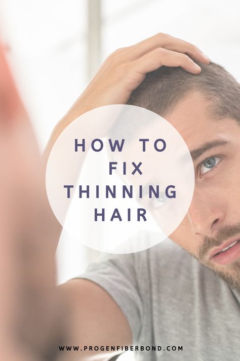 How To Fix Thinning Hair, Fix Thinning Hair, Thining Hair, Thicker Stronger Hair, Thinning Hair Remedies, Bald Look, Hair Growth Cycle, Dancer Workout, Hair Thinning