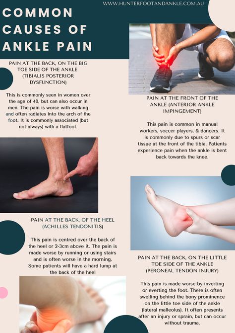 Ankle Health, Ankle Pain Relief, Achilles Pain, Podiatry Clinic, Foot Anatomy, Rehabilitation Exercises, Ankle Surgery, Pain Relief Remedies, Ankle Pain