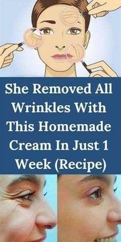 Wrinkles Remedies Face, Wrinkle Remedies, Wrinkle Free Skin, Creme Anti Age, Skin Care Wrinkles, Baking Soda Shampoo, Glow Skin, Natural Anti Aging, Face Wrinkles