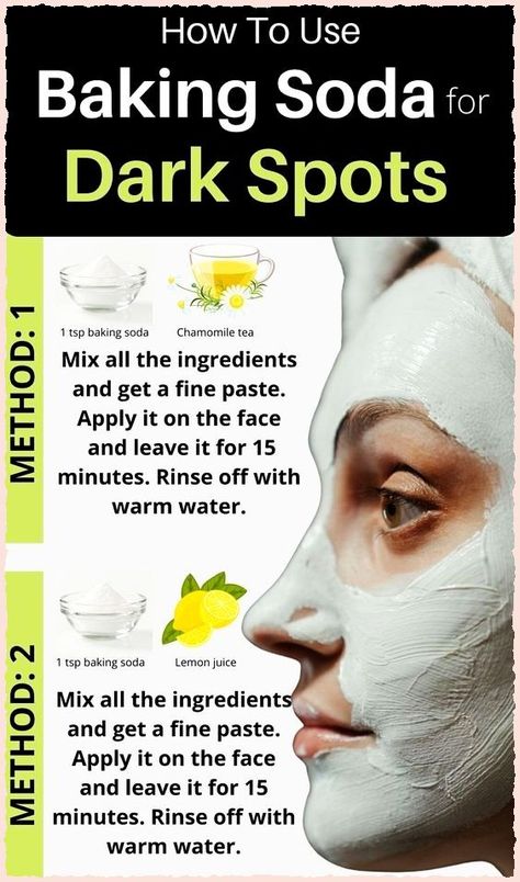 Baking Soda Lemon Juice, Age Spots On Face, Baking Soda Face Mask, Dark Spots Remedies, Baking Soda Face, Mask Recipes, Dark Spots On Face, Brown Spots On Face, Face Mask Recipe