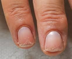 Nail Remedies, Nails After Acrylics, Nail Growth Tips, Split Nails, Cracked Nails, Peeling Nails, Weak Nails, Broken Nails, Nail Repair