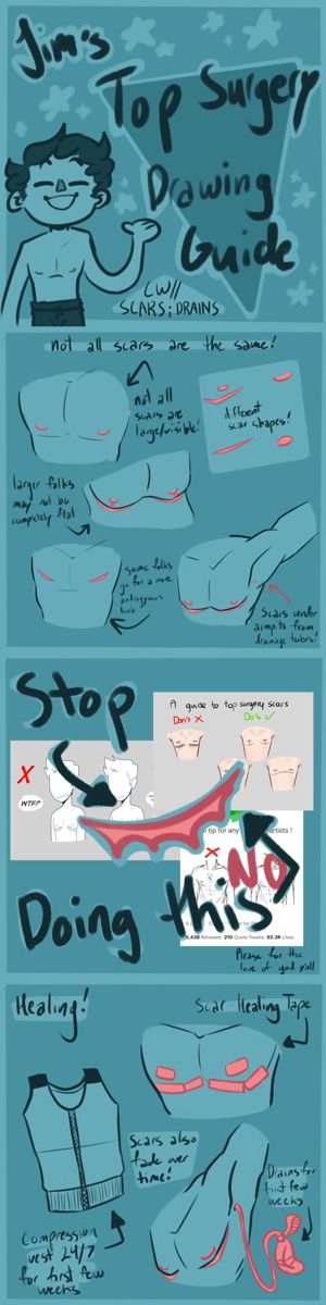 Top Surgery Drawing Reference, Top Scar Drawing, Top Surgery Art Drawing, Healed Burn Scar Reference Drawing, Healed Scar Reference, Trans Scar Reference Drawing, Leg Bandages Drawing Reference, Top Surgery Scar Designs, How To Draw Stylized People