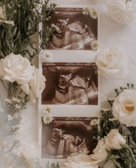 Mini Maternity Shoot, Baby Sonogram Pictures Photo Ideas, Gender Reveal Ideas Cabinet, Floral Baby Announcement, Ultra Sound Picture Ideas, Minimalist Baby Announcement, Pregnancy Documentation Ideas, Flower Baby Announcement, Classy Baby Announcement