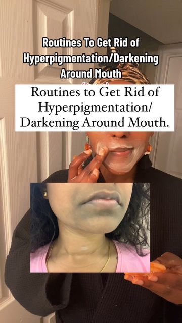 How To Get Rid Of Hyperpigmentation, Hyperpigmentation Around Mouth, Get Rid Of Hyperpigmentation, Azelaic Acid, Kojic Acid, August 20, Glycolic Acid, Care Routine, Beauty Health