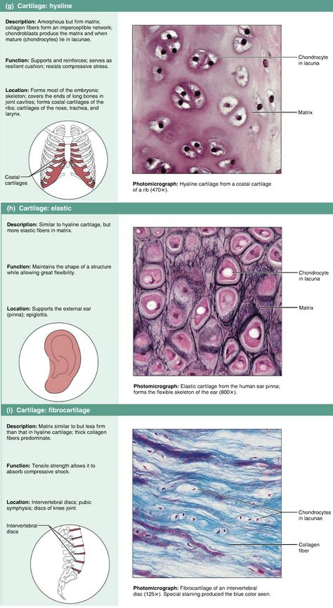 Connective tissues. Cartilage - Hyaline, elastic, fibrocartilage Hyaline Cartilage Tissue, Histology Notes, Histology Technician, Anatomy Tissues, Histology Epithelial Tissue, Connective Tissue Anatomy, Hyaline Cartilage, Bone Tissue Histology, Connective Tissue Histology